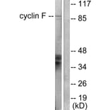 Western Blot - Anti-Cyclin F Antibody (C0168) - Antibodies.com
