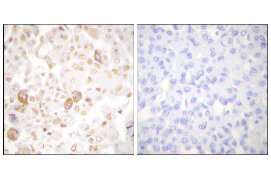 Immunohistochemistry - Anti-Cyclin F Antibody (C0168) - Antibodies.com