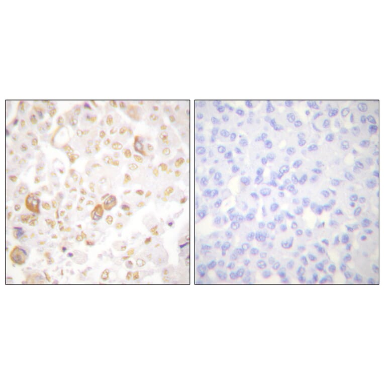 Immunohistochemistry - Anti-Cyclin F Antibody (C0168) - Antibodies.com