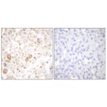 Immunohistochemistry - Anti-Cyclin F Antibody (C0168) - Antibodies.com