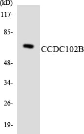Western blot analysis of the lysates from HUVEC cells using Anti-CCDC102B Antibody.