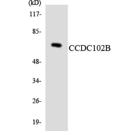 Western Blot - Anti-CCDC102B Antibody (R12-2575) - Antibodies.com