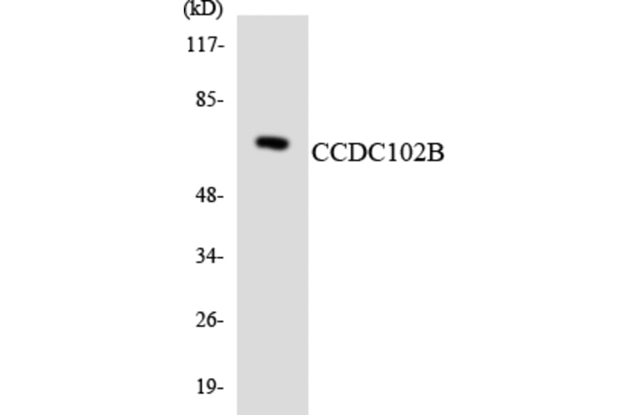 Western Blot - Anti-CCDC102B Antibody (R12-2575) - Antibodies.com