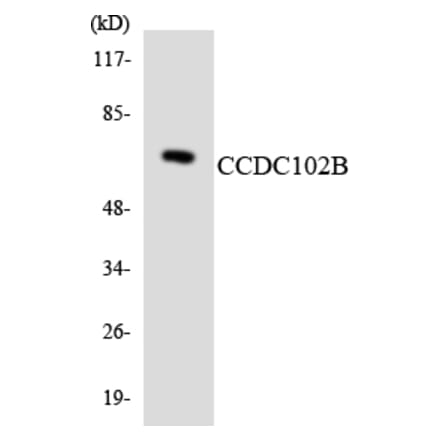 Western Blot - Anti-CCDC102B Antibody (R12-2575) - Antibodies.com