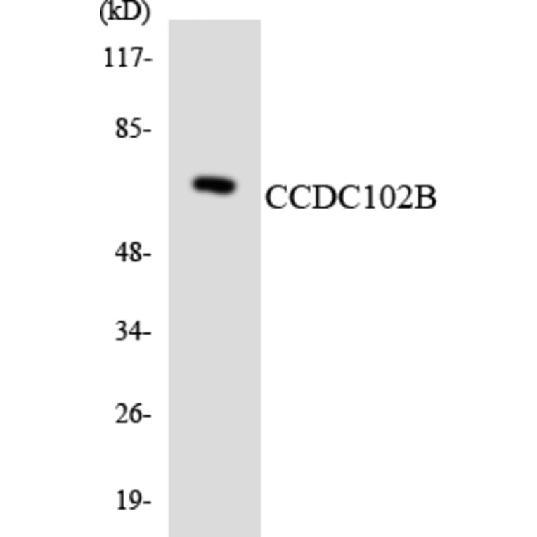 Western Blot - Anti-CCDC102B Antibody (R12-2575) - Antibodies.com