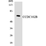 Western Blot - Anti-CCDC102B Antibody (R12-2575) - Antibodies.com