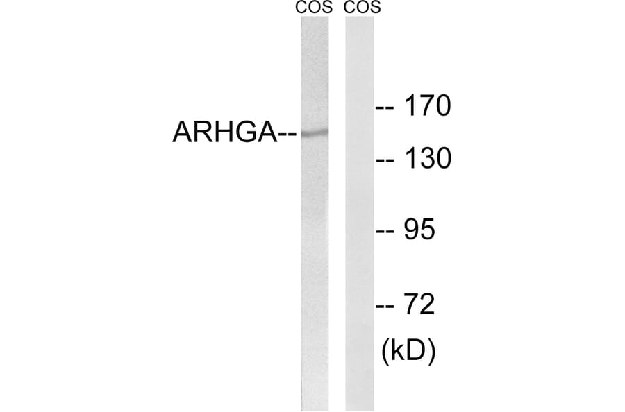 Western Blot - Anti-ARHGEF10 Antibody (C18386) - Antibodies.com