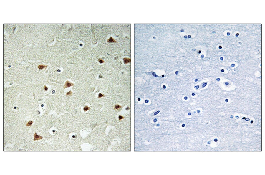 Immunohistochemistry - Anti-ABHD14B Antibody (C14213) - Antibodies.com