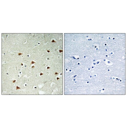 Immunohistochemistry - Anti-ABHD14B Antibody (C14213) - Antibodies.com