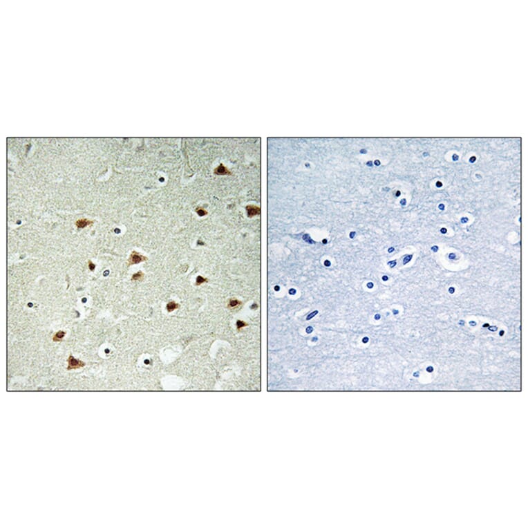 Immunohistochemistry - Anti-ABHD14B Antibody (C14213) - Antibodies.com