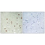Immunohistochemistry - Anti-ABHD14B Antibody (C14213) - Antibodies.com