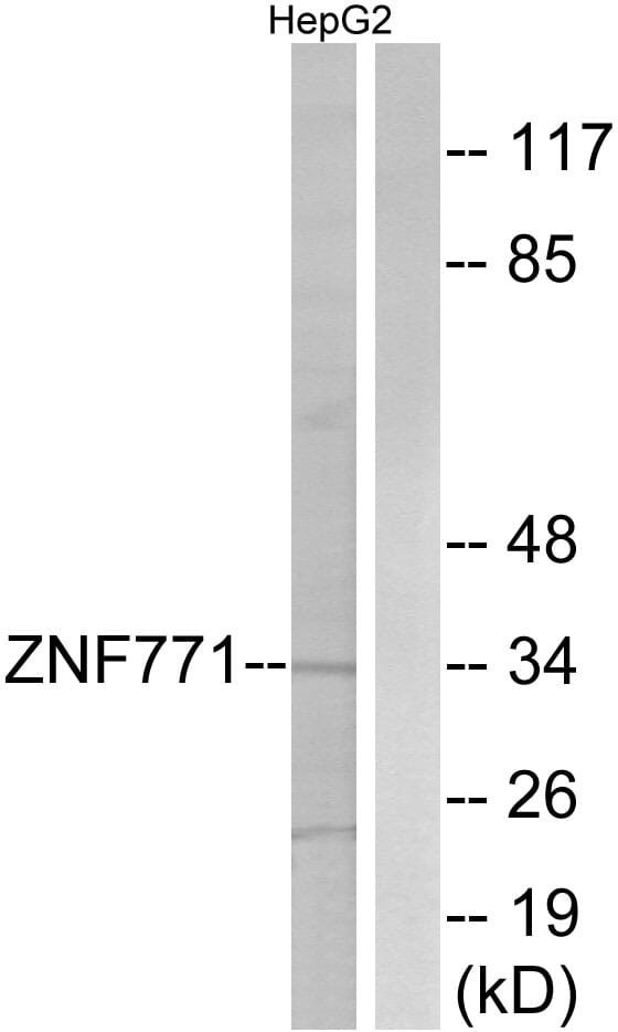 Western blot analysis of lysates from HepG2 cells using Anti-ZNF771 Antibody. The right hand lane represents a negative control, where the antibody is blocked by the immunising peptide.