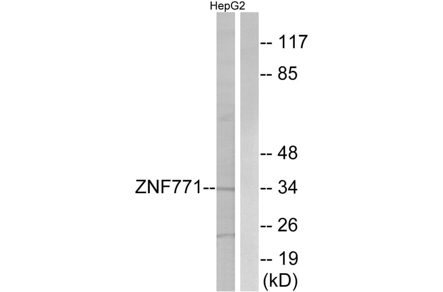 Western Blot - Anti-ZNF771 Antibody (C19608) - Antibodies.com