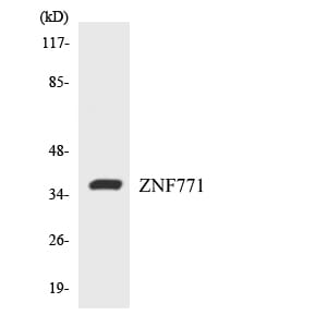 Western blot analysis of the lysates from HUVEC cells using Anti-ZNF771 Antibody.