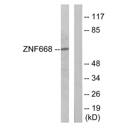 Western Blot - Anti-ZNF668 Antibody (C11507) - Antibodies.com