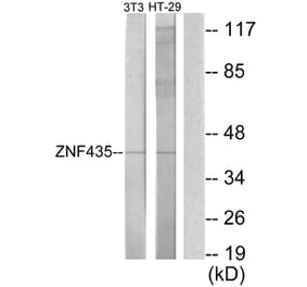 Western Blot - Anti-ZNF435 Antibody (C11695) - Antibodies.com