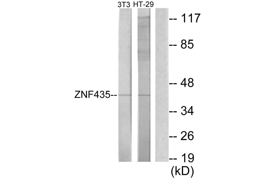 Western Blot - Anti-ZNF435 Antibody (C11695) - Antibodies.com