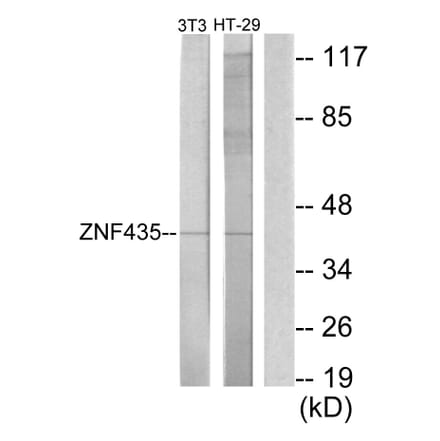 Western Blot - Anti-ZNF435 Antibody (C11695) - Antibodies.com