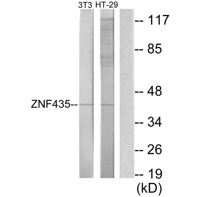 Western Blot - Anti-ZNF435 Antibody (C11695) - Antibodies.com