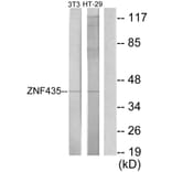 Western Blot - Anti-ZNF435 Antibody (C11695) - Antibodies.com