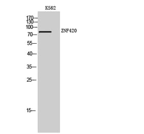 Western Blot - Anti-ZNF420 Antibody (C19599) - Antibodies.com