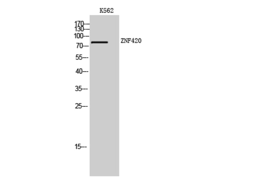 Western Blot - Anti-ZNF420 Antibody (C19599) - Antibodies.com