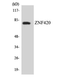 Western Blot - Anti-ZNF420 Antibody (R12-3700) - Antibodies.com