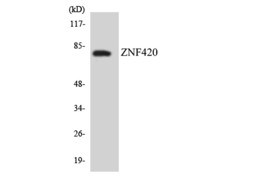Western Blot - Anti-ZNF420 Antibody (R12-3700) - Antibodies.com