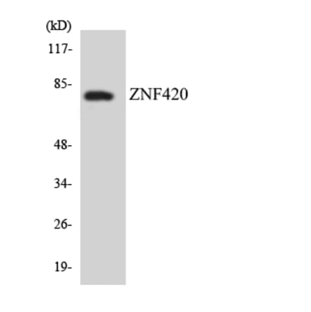 Western Blot - Anti-ZNF420 Antibody (R12-3700) - Antibodies.com