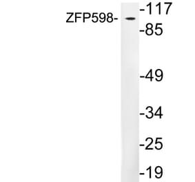 Western Blot - Anti-ZFP598 Antibody (R12-2416) - Antibodies.com