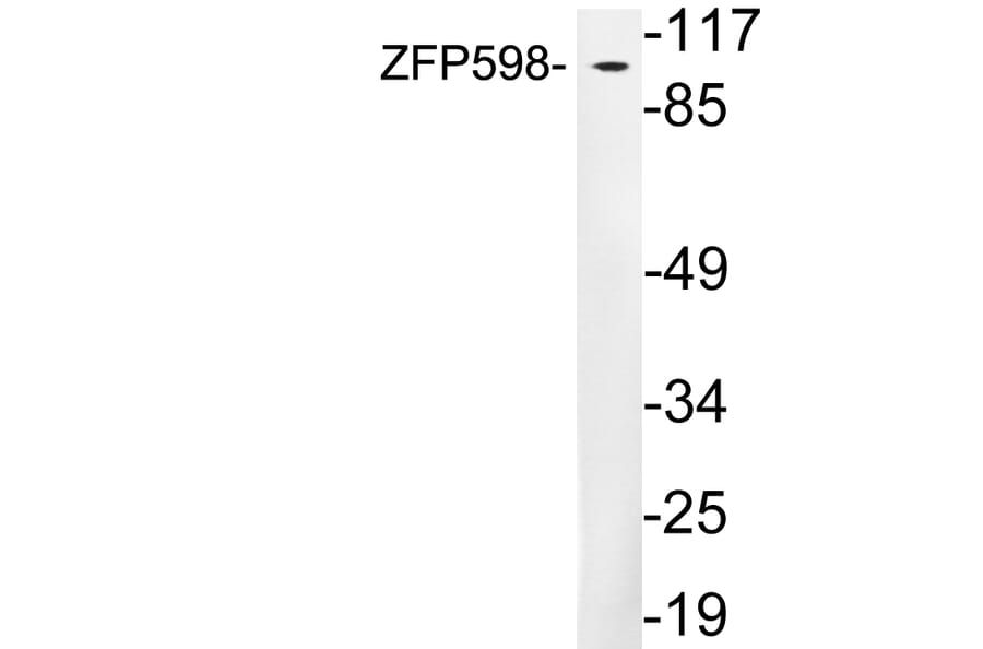 Western Blot - Anti-ZFP598 Antibody (R12-2416) - Antibodies.com