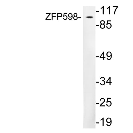 Western Blot - Anti-ZFP598 Antibody (R12-2416) - Antibodies.com