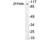Western Blot - Anti-ZFP598 Antibody (R12-2416) - Antibodies.com