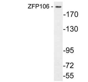 Western Blot - Anti-ZFP106 Antibody (R12-2415) - Antibodies.com