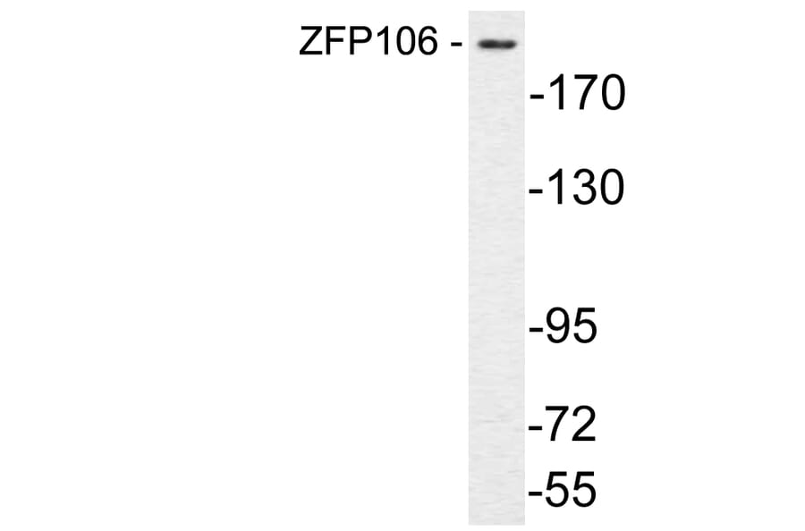 Western Blot - Anti-ZFP106 Antibody (R12-2415) - Antibodies.com
