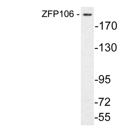 Western Blot - Anti-ZFP106 Antibody (R12-2415) - Antibodies.com