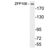Western Blot - Anti-ZFP106 Antibody (R12-2415) - Antibodies.com