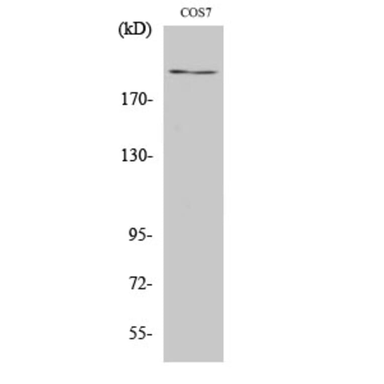 Western Blot - Anti-ZFP106 Antibody (R12-2415) - Antibodies.com