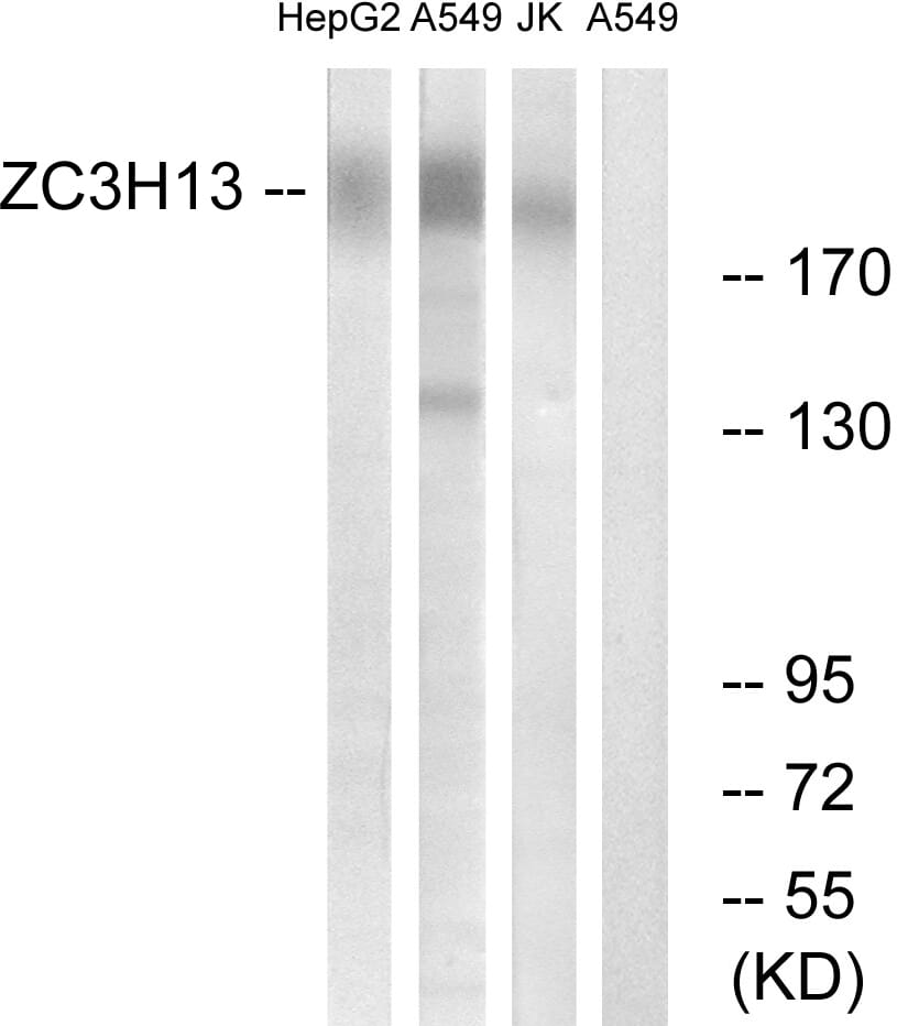 Western blot analysis of lysates from A549, Jurkat, HepG2 cells using Anti-ZC3H13 Antibody. The right hand lane represents a negative control, where the antibody is blocked by the immunising peptide.