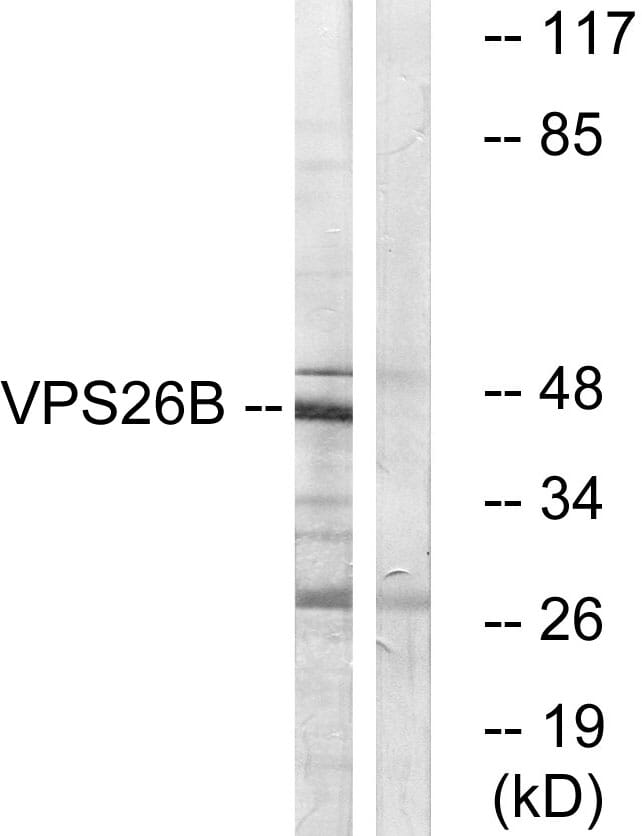 Western blot analysis of lysates from LOVO cells using Anti-VPS26B Antibody. The right hand lane represents a negative control, where the antibody is blocked by the immunising peptide.