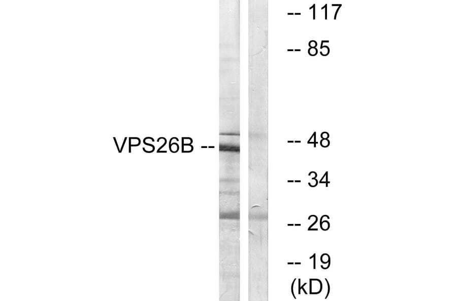 Western Blot - Anti-VPS26B Antibody (C19486) - Antibodies.com
