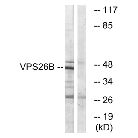 Western Blot - Anti-VPS26B Antibody (C19486) - Antibodies.com