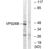 Western Blot - Anti-VPS26B Antibody (C19486) - Antibodies.com