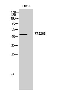 Western blot analysis of LOVO cells using Anti-VPS26B Antibody.
