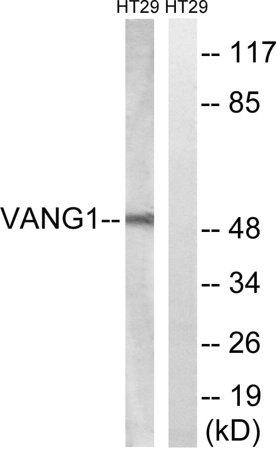 Western blot analysis of lysates from HT-29 cells using Anti-VANGL1 Antibody. The right hand lane represents a negative control, where the antibody is blocked by the immunising peptide.