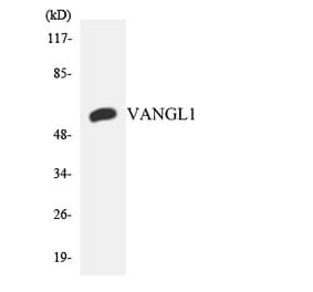 Western Blot - Anti-VANGL1 Antibody (R12-3673) - Antibodies.com