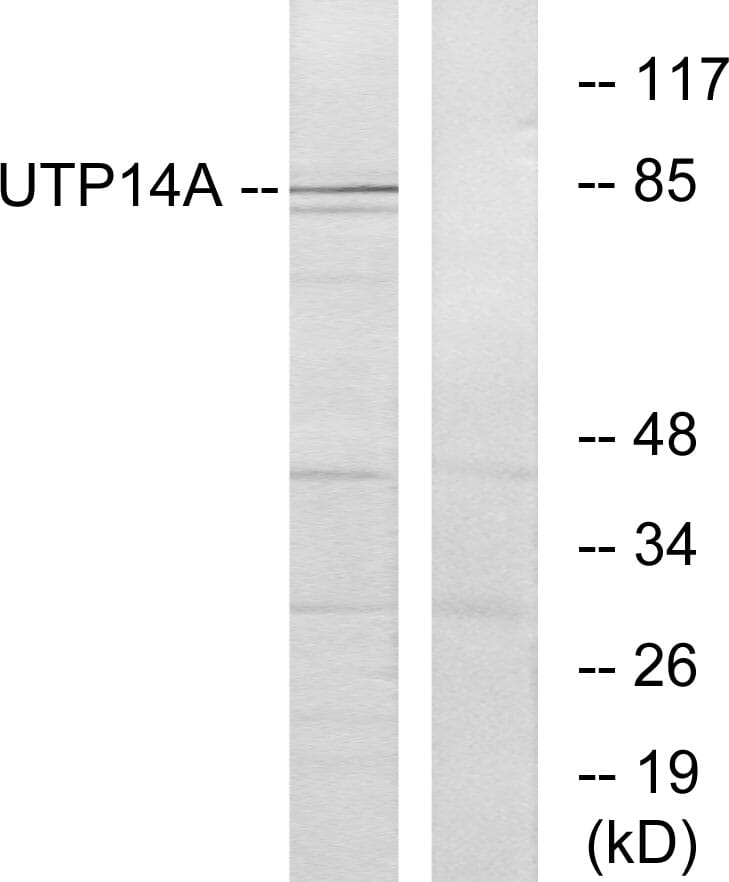 Western blot analysis of lysates from HeLa cells using Anti-UTP14A Antibody. The right hand lane represents a negative control, where the antibody is blocked by the immunising peptide.