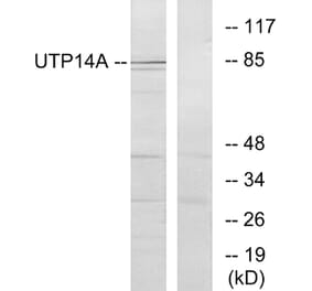Western Blot - Anti-UTP14A Antibody (C11624) - Antibodies.com