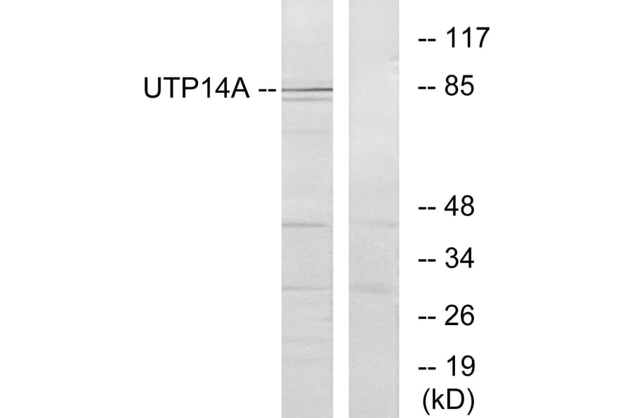 Western Blot - Anti-UTP14A Antibody (C11624) - Antibodies.com