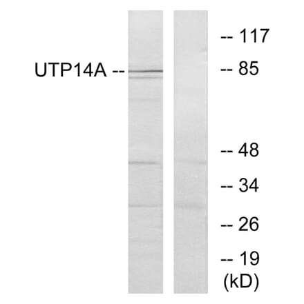 Western Blot - Anti-UTP14A Antibody (C11624) - Antibodies.com
